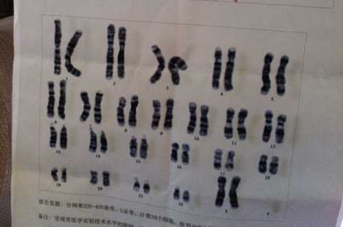 上海代生需要多少费用，试管婴儿前为什么要检查染色体？三代试管筛查会影响